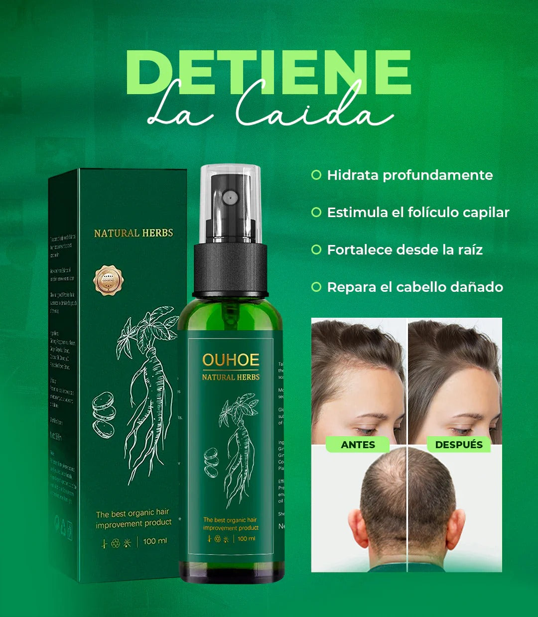 Spray OUHOE® 2X1 - Tratamiento Para Prevenir La Caída Del Cabello