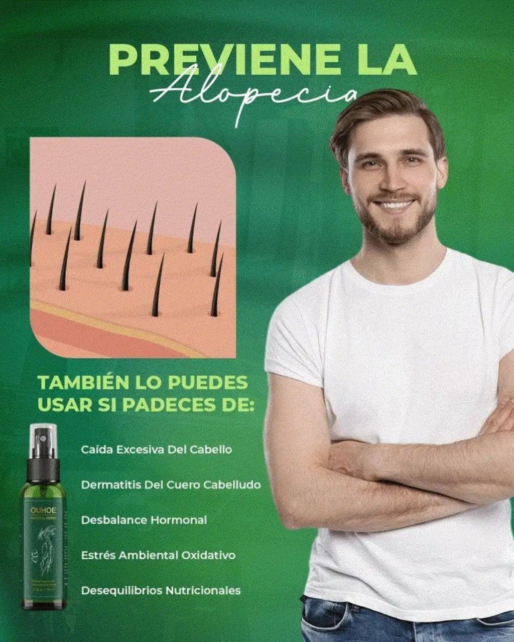 Spray OUHOE® 2X1 - Tratamiento Para Prevenir La Caída Del Cabello